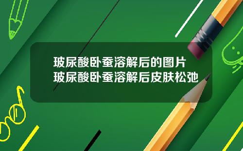 玻尿酸卧蚕溶解后的图片 玻尿酸卧蚕溶解后皮肤松弛