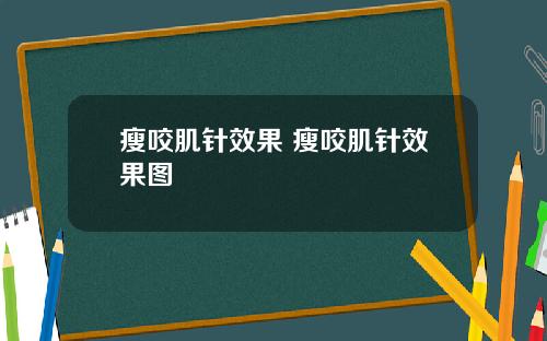 瘦咬肌针效果 瘦咬肌针效果图