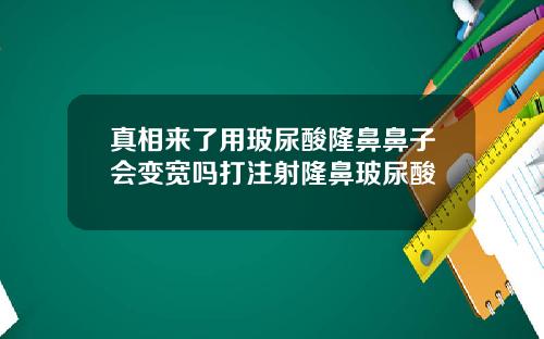 真相来了用玻尿酸隆鼻鼻子会变宽吗打注射隆鼻玻尿酸