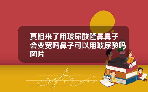 真相来了用玻尿酸隆鼻鼻子会变宽吗鼻子可以用玻尿酸吗图片