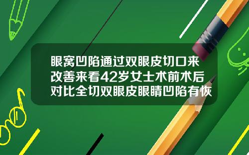 眼窝凹陷通过双眼皮切口来改善来看42岁女士术前术后对比全切双眼皮眼睛凹陷有恢复好的吗