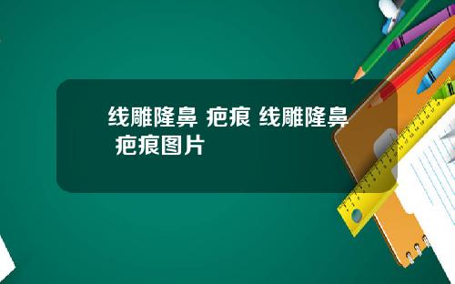 线雕隆鼻 疤痕 线雕隆鼻 疤痕图片
