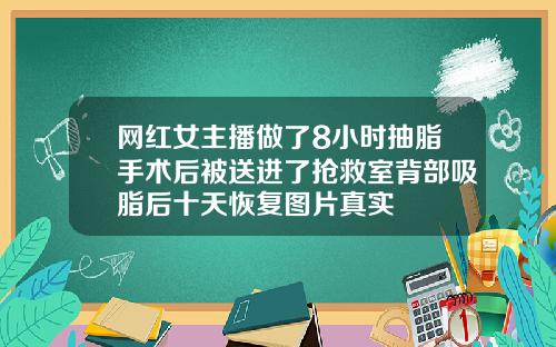 网红女主播做了8小时抽脂手术后被送进了抢救室背部吸脂后十天恢复图片真实