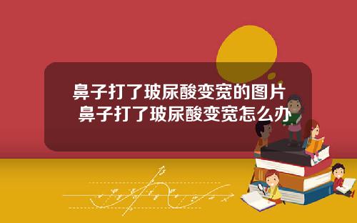 鼻子打了玻尿酸变宽的图片 鼻子打了玻尿酸变宽怎么办