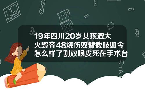 19年四川20岁女孩遭大火毁容48烧伤双臂截肢如今怎么样了割双眼皮死在手术台上