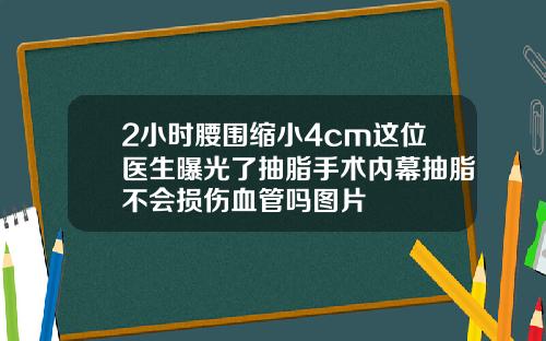 2小时腰围缩小4cm这位医生曝光了抽脂手术内幕抽脂不会损伤血管吗图片