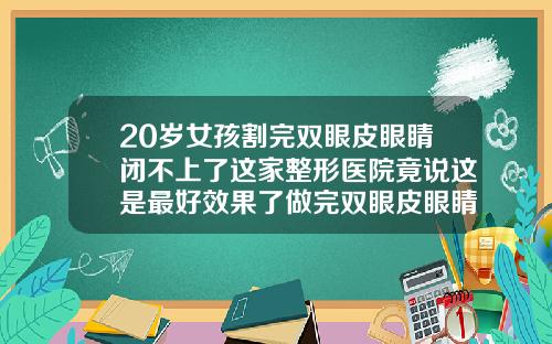 20岁女孩割完双眼皮眼睛闭不上了这家整形医院竟说这是最好效果了做完双眼皮眼睛闭不住怎么办