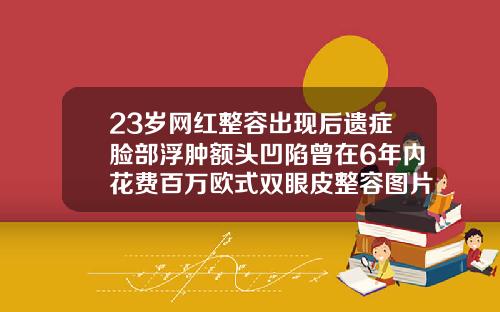 23岁网红整容出现后遗症脸部浮肿额头凹陷曾在6年内花费百万欧式双眼皮整容图片