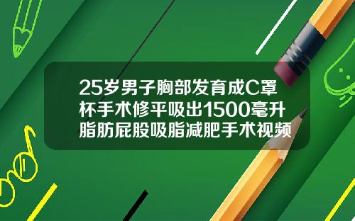 25岁男子胸部发育成C罩杯手术修平吸出1500毫升脂肪屁股吸脂减肥手术视频