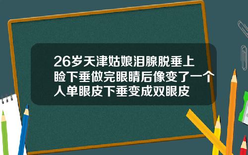 26岁天津姑娘泪腺脱垂上睑下垂做完眼睛后像变了一个人单眼皮下垂变成双眼皮