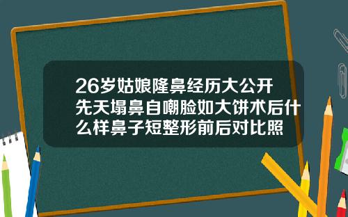 26岁姑娘隆鼻经历大公开先天塌鼻自嘲脸如大饼术后什么样鼻子短整形前后对比照