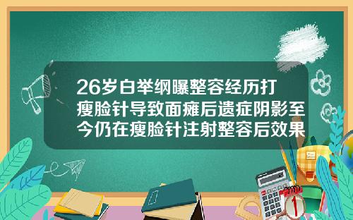 26岁白举纲曝整容经历打瘦脸针导致面瘫后遗症阴影至今仍在瘦脸针注射整容后效果图