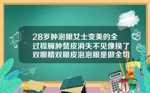 28岁肿泡眼女士变美的全过程臃肿赘皮消失不见像换了双眼睛双眼皮泡泡眼是做全切还是微创