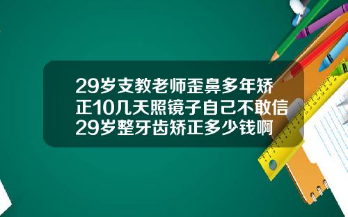 29岁支教老师歪鼻多年矫正10几天照镜子自己不敢信29岁整牙齿矫正多少钱啊
