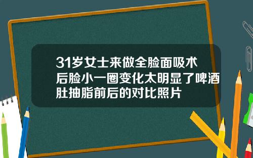 31岁女士来做全脸面吸术后脸小一圈变化太明显了啤酒肚抽脂前后的对比照片