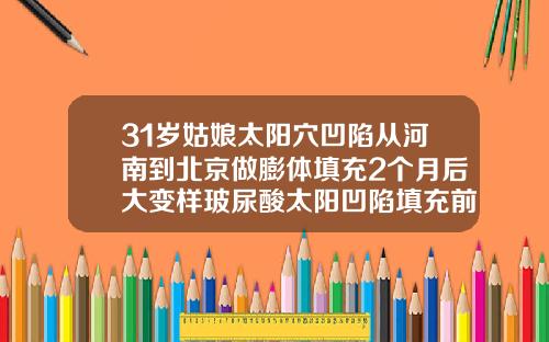 31岁姑娘太阳穴凹陷从河南到北京做膨体填充2个月后大变样玻尿酸太阳凹陷填充前后图片
