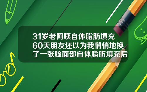 31岁老阿姨自体脂肪填充60天朋友还以为我悄悄地换了一张脸面部自体脂肪填充后多久可以洗脸化妆