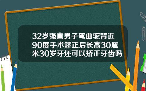 32岁强直男子弯曲驼背近90度手术矫正后长高30厘米30岁牙还可以矫正牙齿吗