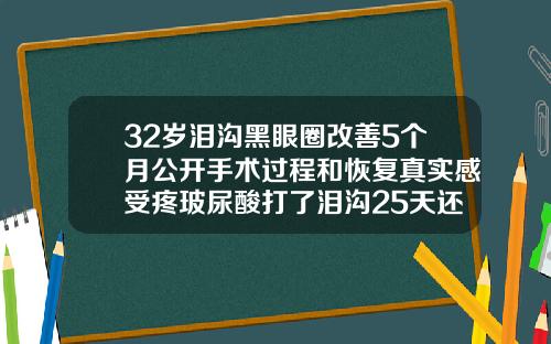 32岁泪沟黑眼圈改善5个月公开手术过程和恢复真实感受疼玻尿酸打了泪沟25天还肿