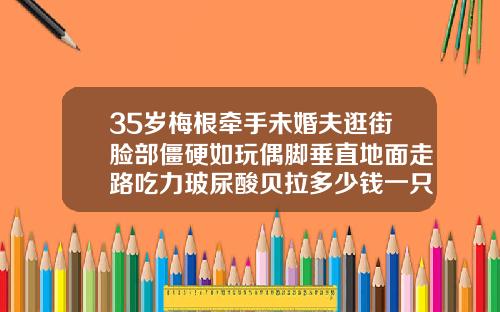 35岁梅根牵手未婚夫逛街脸部僵硬如玩偶脚垂直地面走路吃力玻尿酸贝拉多少钱一只