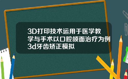 3D打印技术运用于医学教学与手术以口腔颌面治疗为例3d牙齿矫正模拟