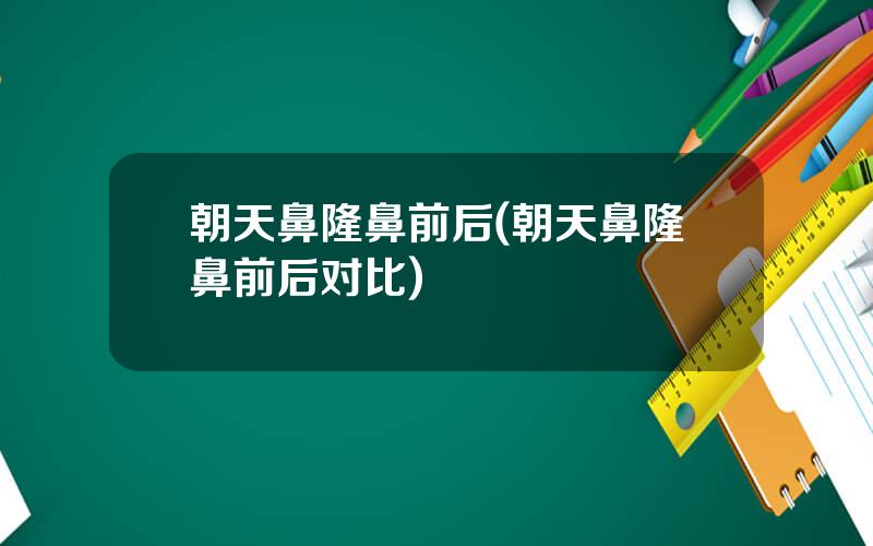 朝天鼻隆鼻前后(朝天鼻隆鼻前后对比)